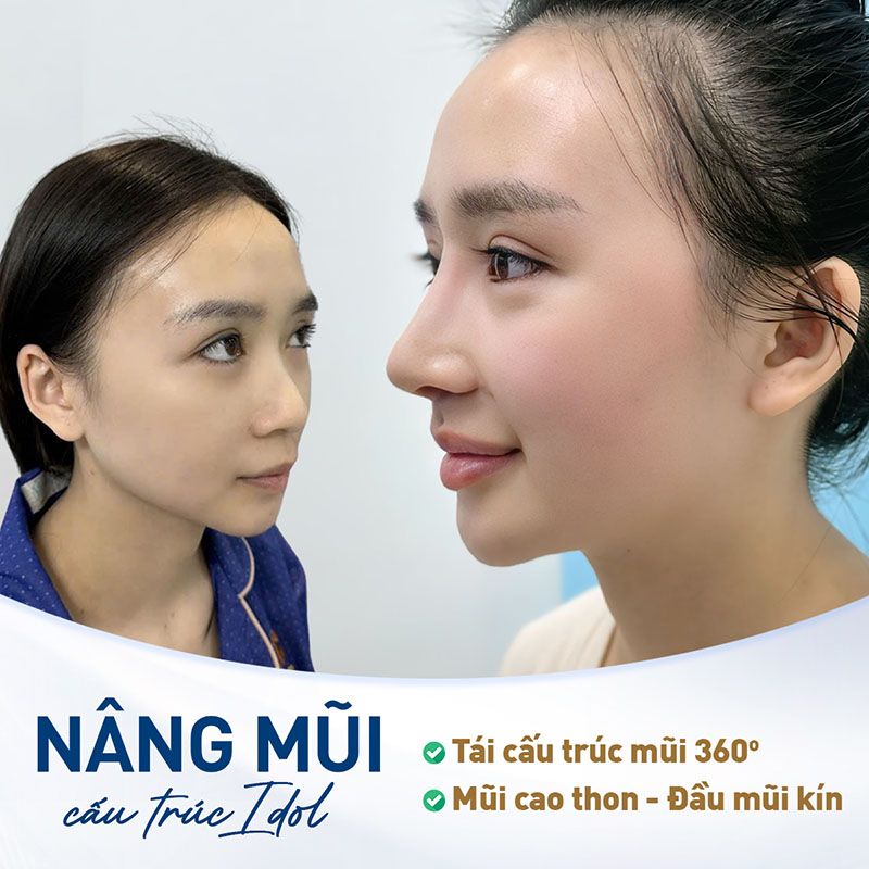 Kangnam Thanh Hóa là địa chỉ làm đẹp uy tín, tạo dáng mũi độc bản