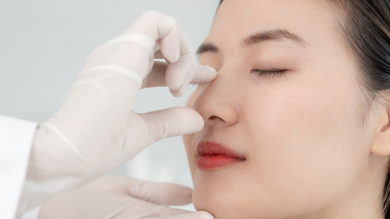 Nâng mũi dựng trụ khắc phục hiệu quả các khuyết điểm: đầu mũi to, mũi ngắn, lệch