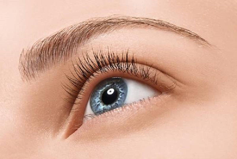 Nhấn mí vi sợi không cần phẫu thuật hay cắt rạch