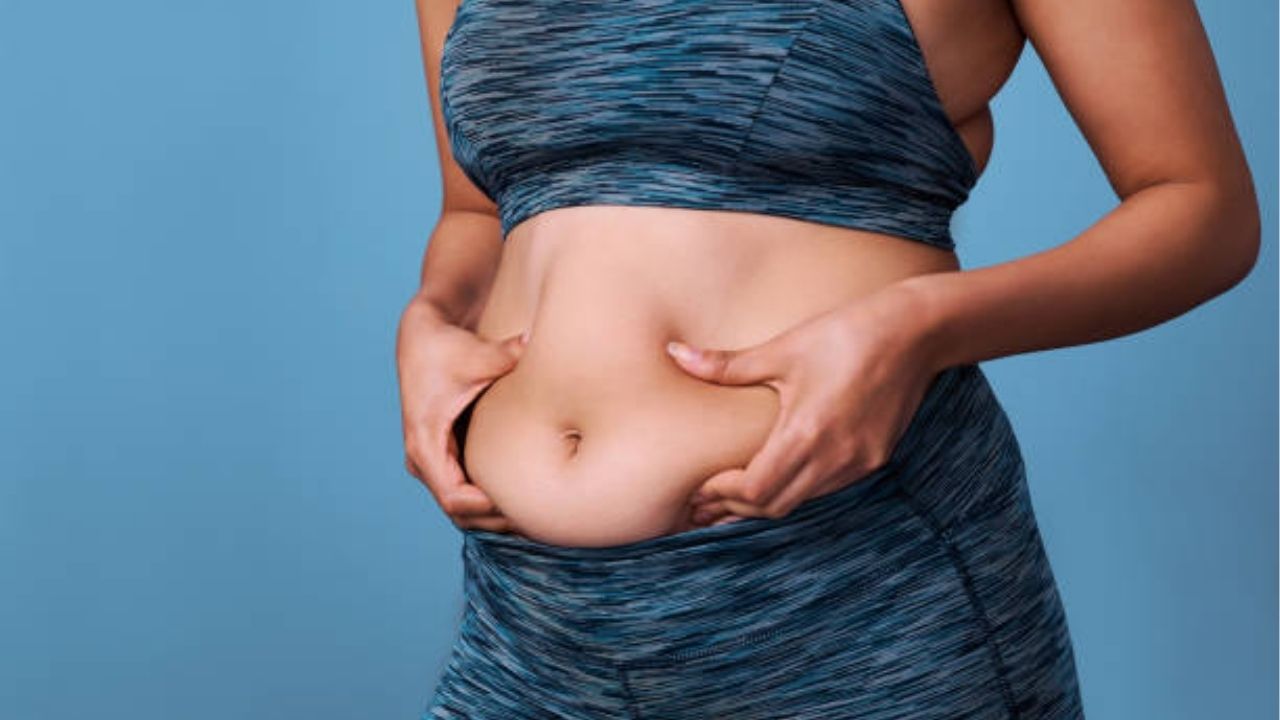 tình trạng Mỡ bụng tích ở vùng bụng phía dưới rốn