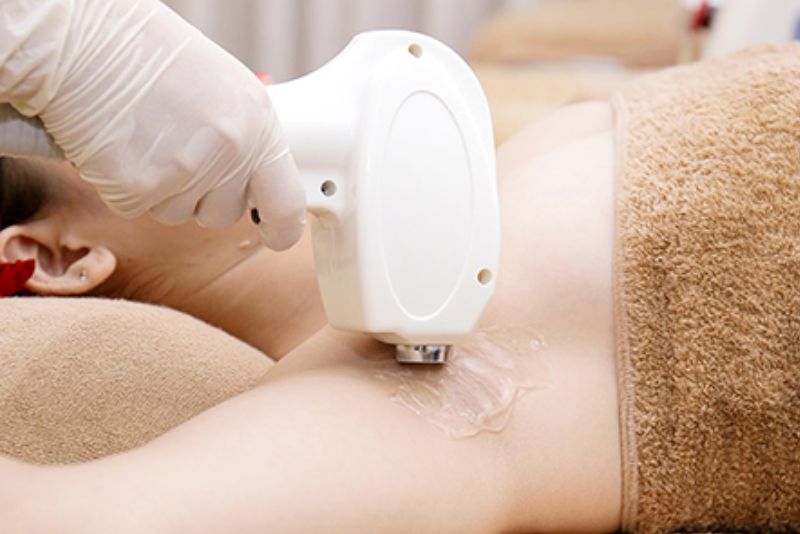 Năng lượng ánh sáng phát ra từ máy sẽ hấp thụ bởi melanin trong sợi lông