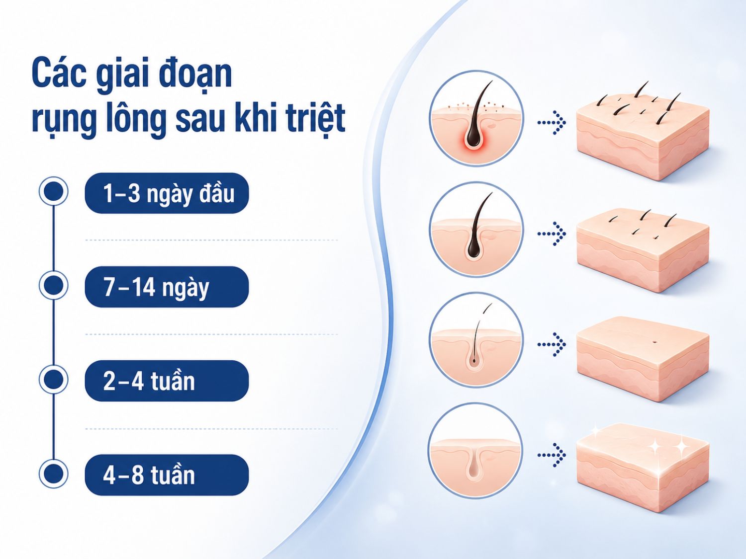 Sau triệt lông, lông không rụng ngay lập tức mà thường yếu dần rồi rụng theo từng giai đoạn. Tốc độ rụng có thể khác nhau tùy cơ địa, vùng triệt và công nghệ sử dụng.