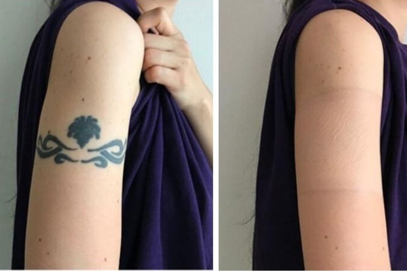 Miếng dán giúp che giấu hình xăm tạm thời