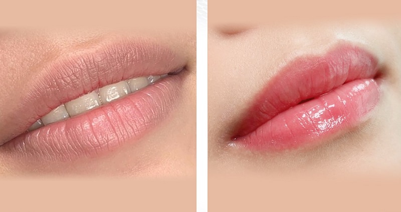 Nên quan sát những triệu chứng bất thường sau phun môi