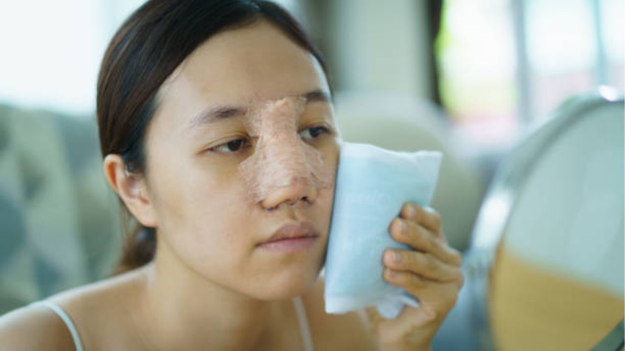 Thực hiện chườm lạnh xung quanh vùng mũi (trán, má, mắt) sau phẫu thuật