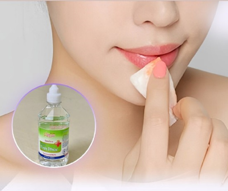 Chị em nên làm sạch môi bằng nước muối sinh lý