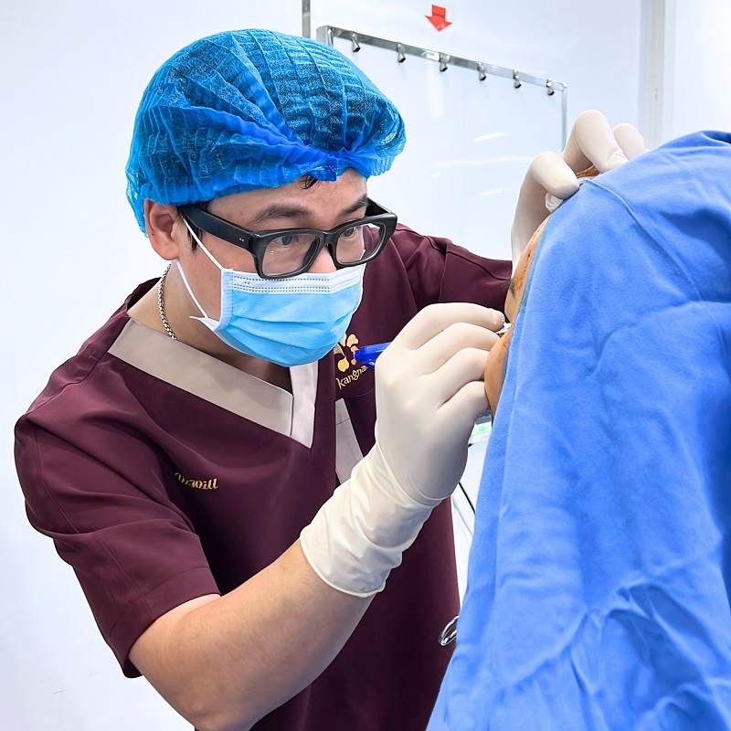 Bác sĩ đánh dấu vị trí cần nhấn mí