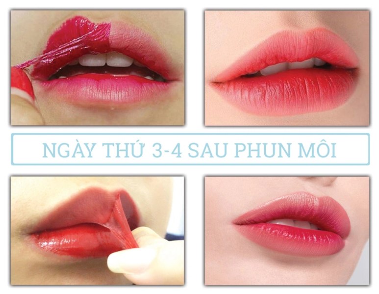 Sau vài ngày môi sẽ bong tróc tự nhiên