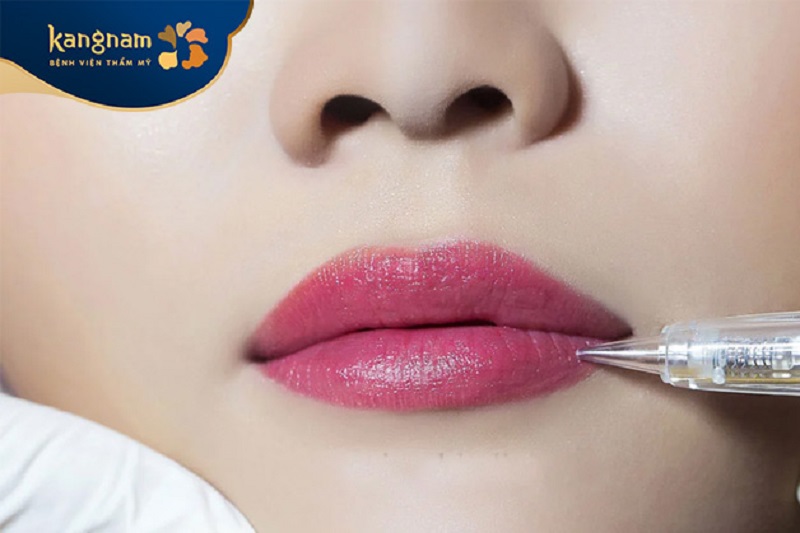 Phun môi Nano sử dụng thiết bị chuyên dùng cùng đầu kim nhỏ để đưa mục vào môi