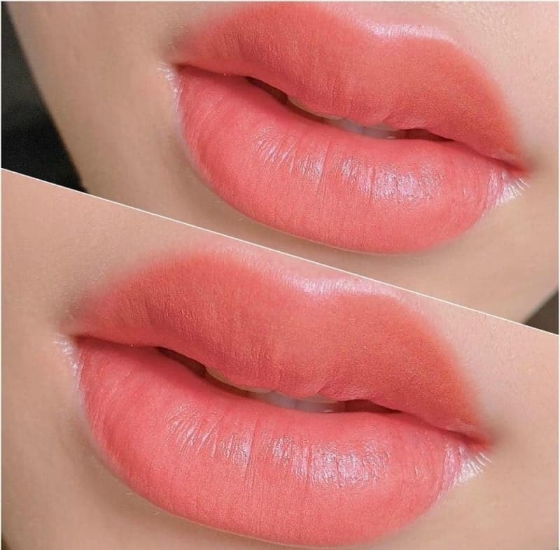 Phun môi tế bào gốc khắc phục được khuyết điểm của môi