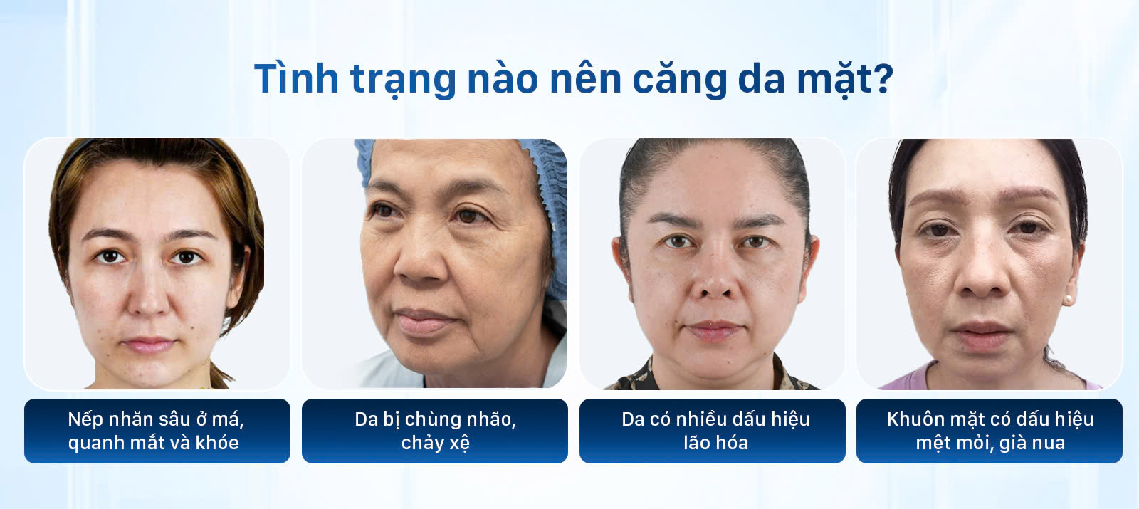 các tình trạng cần phẫu thuật căng da mặt