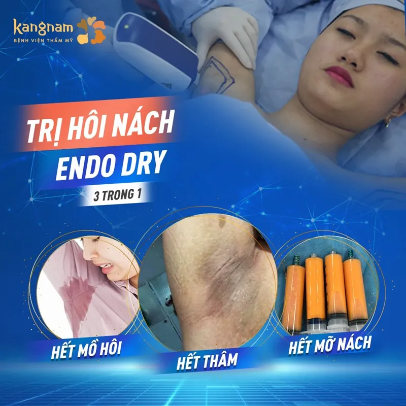 Endo Dry trị hết mồ hôi, hết thâm và hết mỡ nách