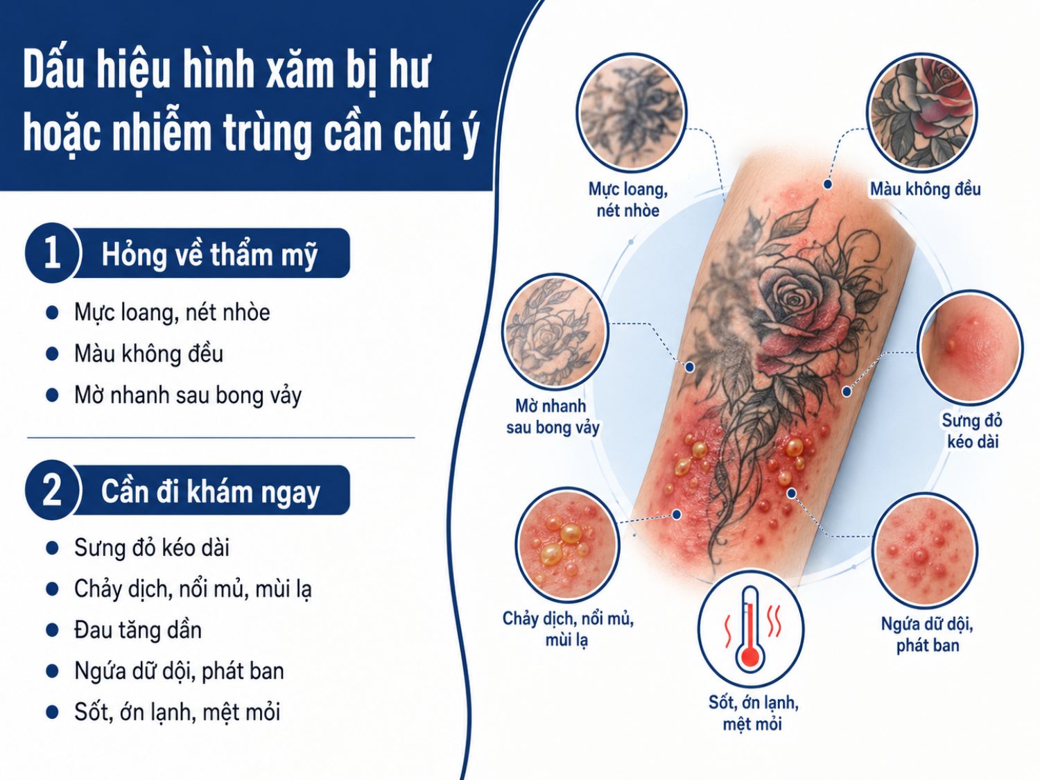 Nếu hình xăm có dấu hiệu loang màu, mờ nhanh, sưng đỏ kéo dài, chảy dịch, nổi mủ hoặc kèm sốt, bạn nên đi khám sớm để được kiểm tra và xử lý kịp thời.