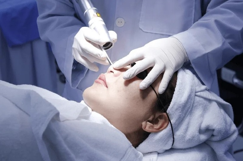 Kỹ thuật đốt mụn thịt ảnh hưởng đến chi phí