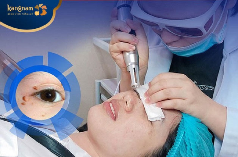 Những địa chỉ uy tín, ứng dụng kỹ thuật hiện đại sẽ có chi phí cao hơn