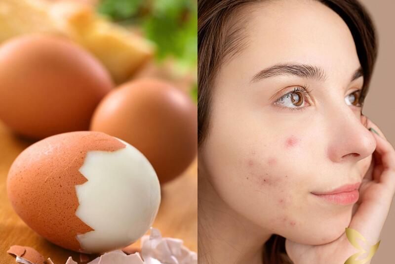 Lăn trứng gà trị thâm mụn