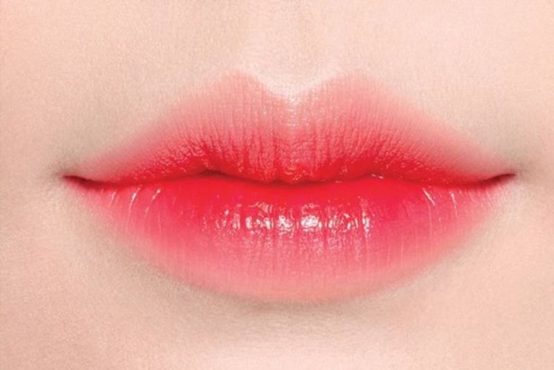 Môi tim có đỉnh nhân trung rõ ràng, tạo ra rãnh nhẹ