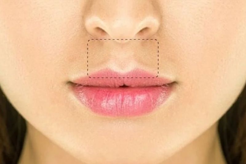 Nhân trung sâu và rộng thể hiện tính cách hiền lành