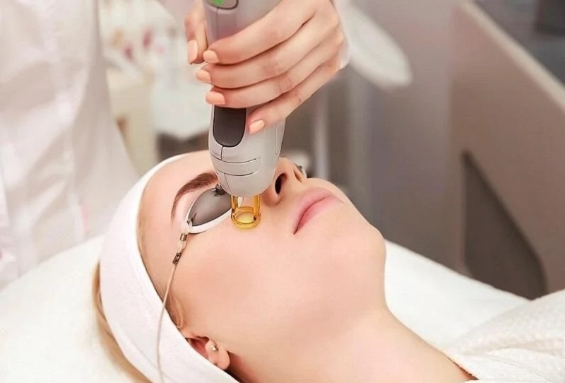Làm sáng da mặt bằng laser dùng bước sóng phù hợp