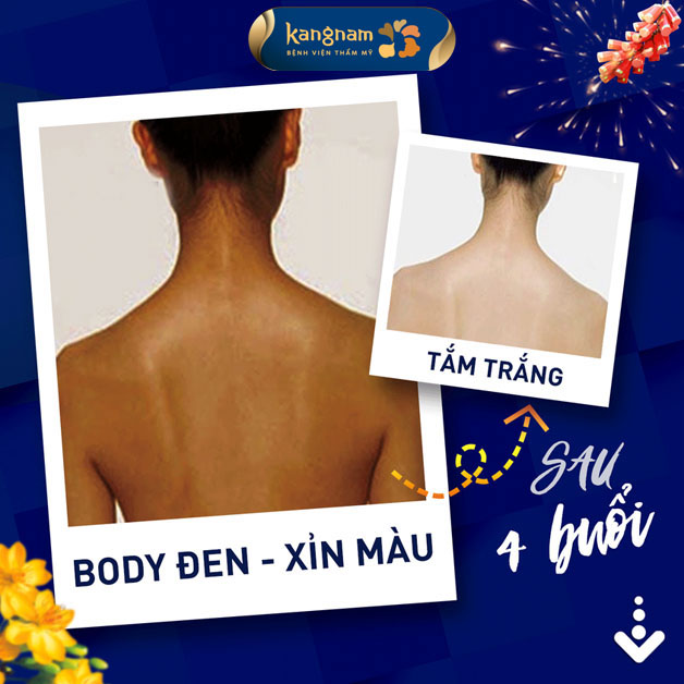 Làn da trắng sáng bật tone chỉ sau vài buổi