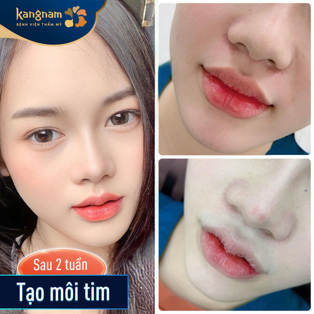 Môi tim xinh tự nhiên, mềm mại