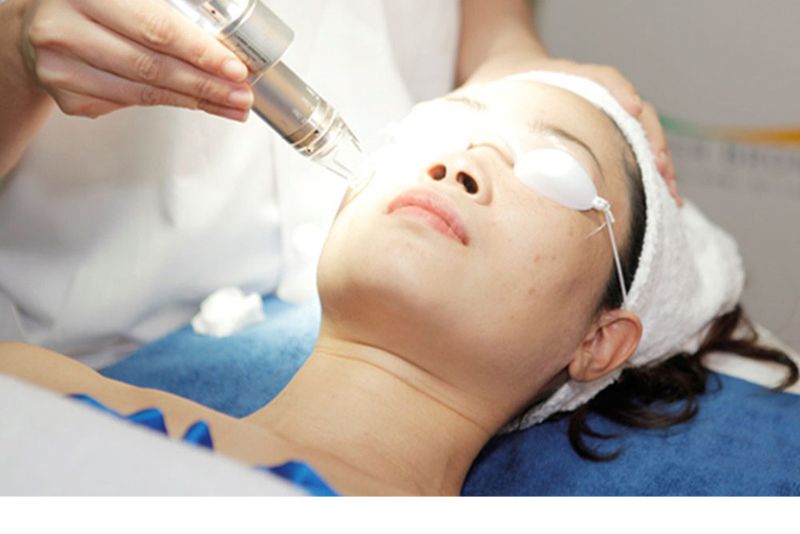 Tia laser tác động chính xác vào vùng thâm mụn.