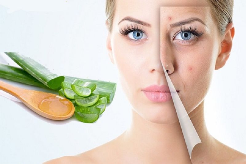 Nha đam chứa nhiều vitamin E và các enzyme giúp làm dịu da, hỗ trợ làm mờ thâm mụn và kích thích tái tạo tế bào mới