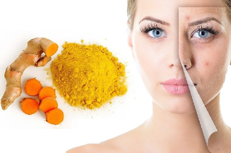 Thoa nghệ lên vùng da có mụn thâm