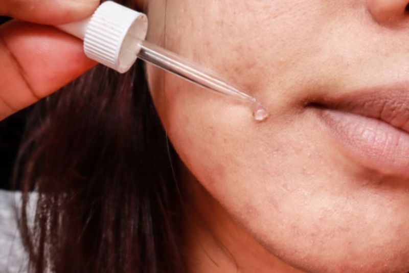 Niacinamide là hoạt chất nhẹ nhàng giúp làm sáng và đều màu da