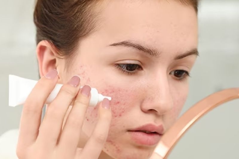Dùng hoạt chất trị thâm