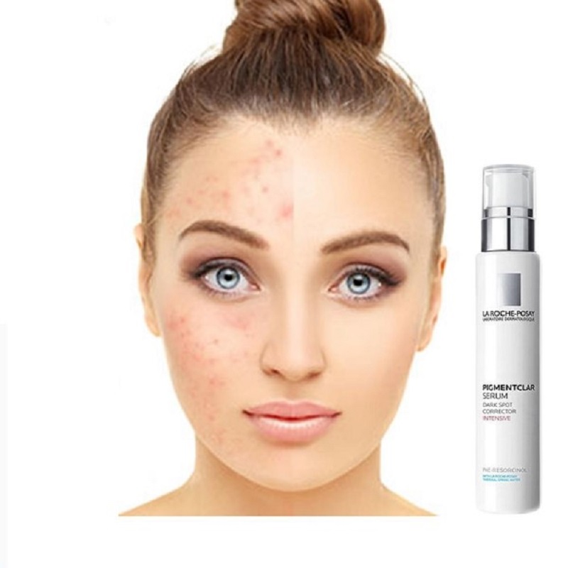La Roche-Posay Pigmentclar Serum có thể làm mờ da thâm sạm