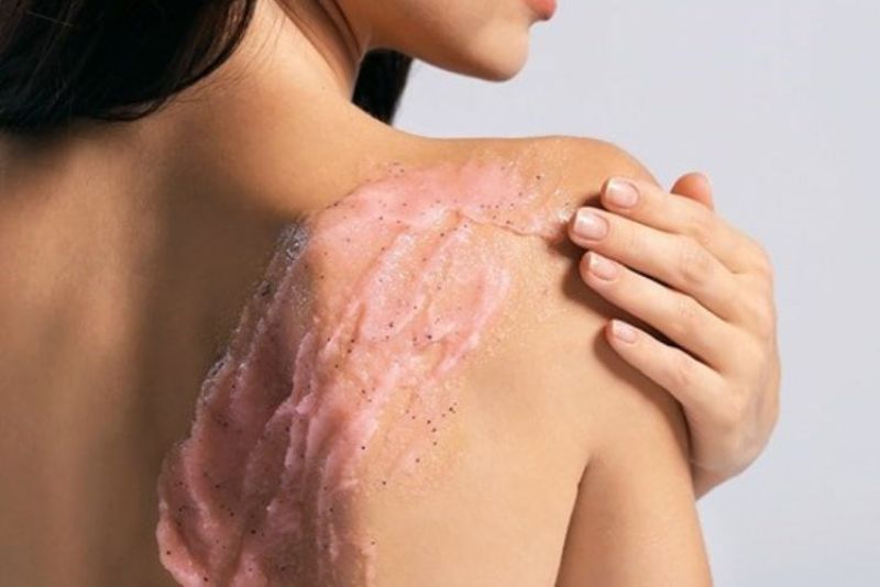 Tẩy tế bào chết định kỳ giúp da thông thoáng và hỗ trợ làm sáng vết thâm