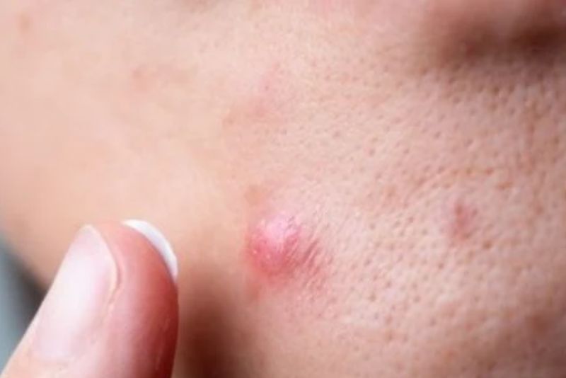 kem có chứa các hoạt chất làm sáng da như Thiamidol, Niacinamide