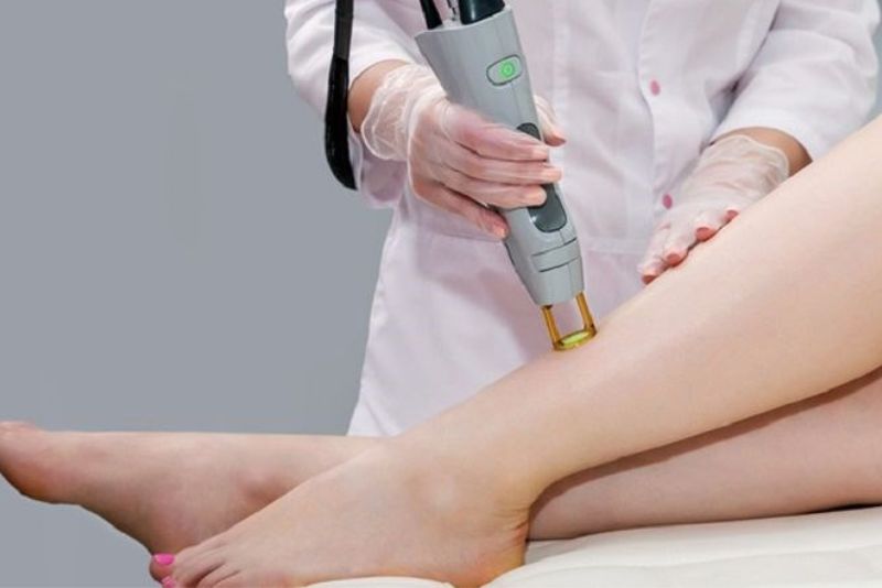 Laser là phương pháp hiện đại và được ưa chuộng nhất để điều trị thâm ở chân