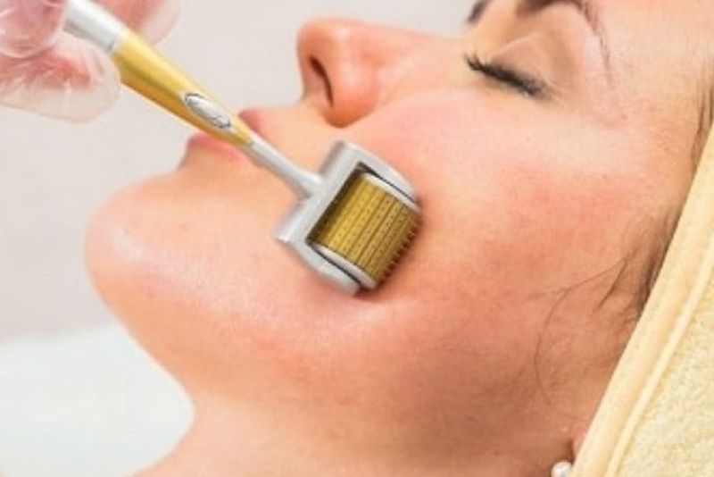 Lăn kim là kỹ thuật sử dụng đầu kim siêu nhỏ để tạo ra các "tổn thương giả" trên bề mặt da, kích thích cơ thể tự sản sinh collagen và elastin