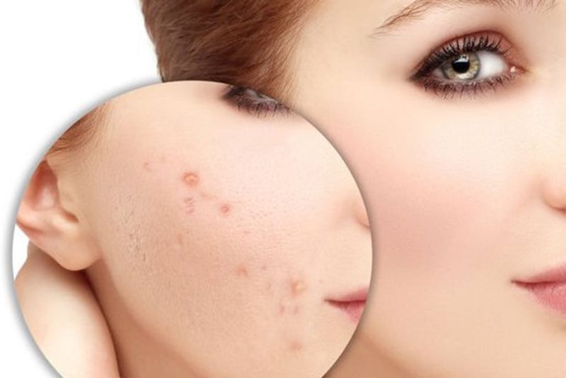 Vitamin C hỗ trợ tái tạo tế bào mới và giảm viêm hiệu quả