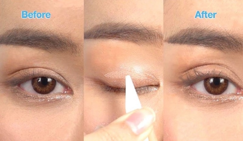 Sử dụng miếng dán để kích 2 mí