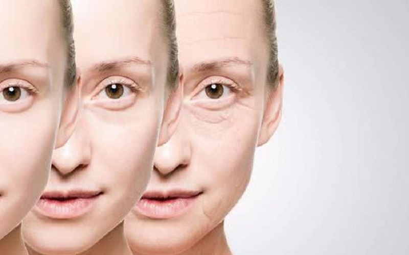 Da vùng mắt bị tác động gây hình thành nếp nhăn, bọng mắt