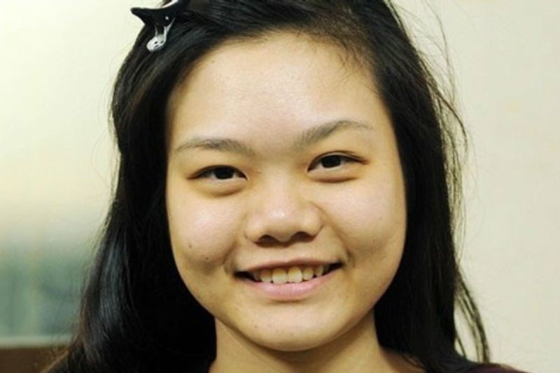 Mũi củ đầy đặn, da mũi dày và phần cánh mũi nở rộng