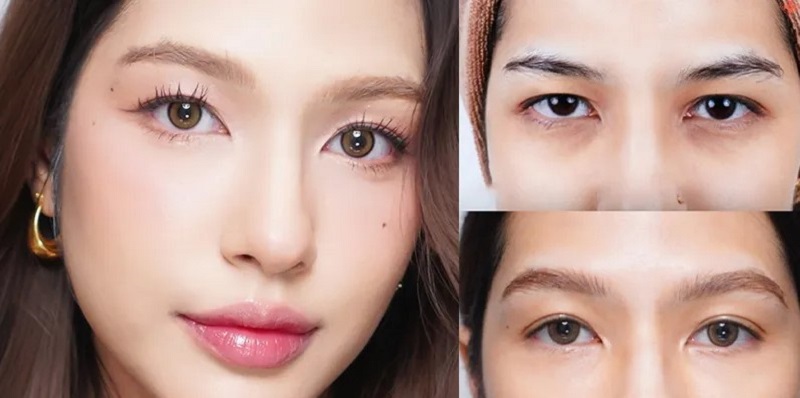Cấy mỡ tự thân tại cơ sở thẩm mỹ uy tín