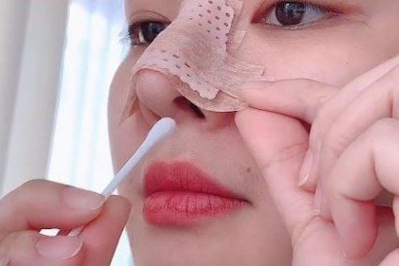 Vệ sinh vùng mũi bằng nước muối sinh lý