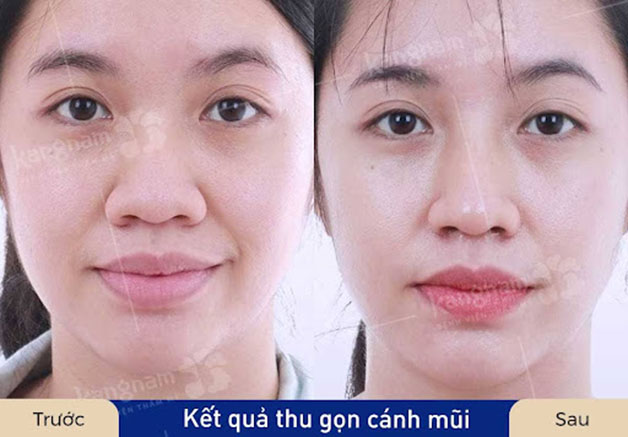 Hồi phục nhanh sau 7 ngày