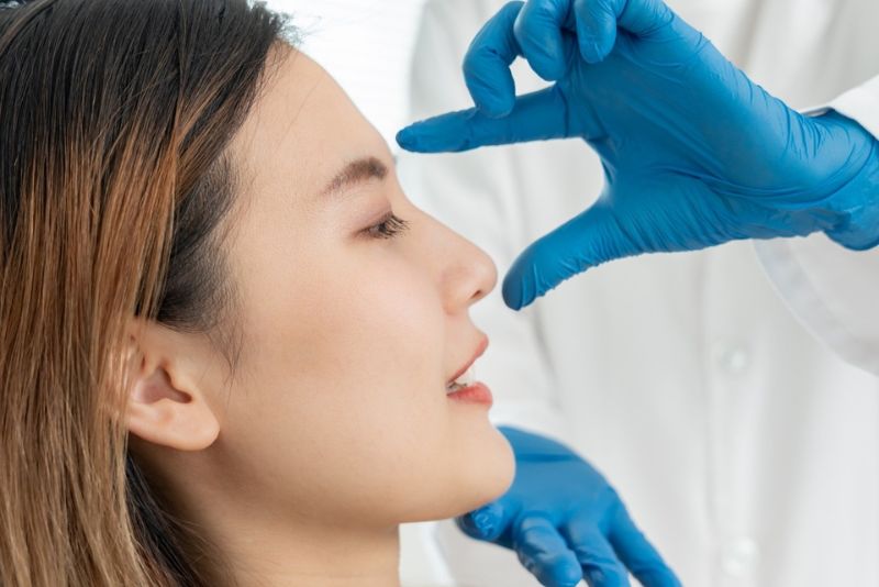 Filler giúp nâng mũi tức thì, không cần nghỉ dưỡng