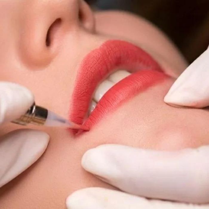 Dùng kim chuyên dụng để khử thâm môi