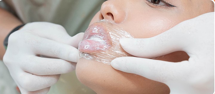 Khách hàng được ủ tê vùng môi để tránh gây đau