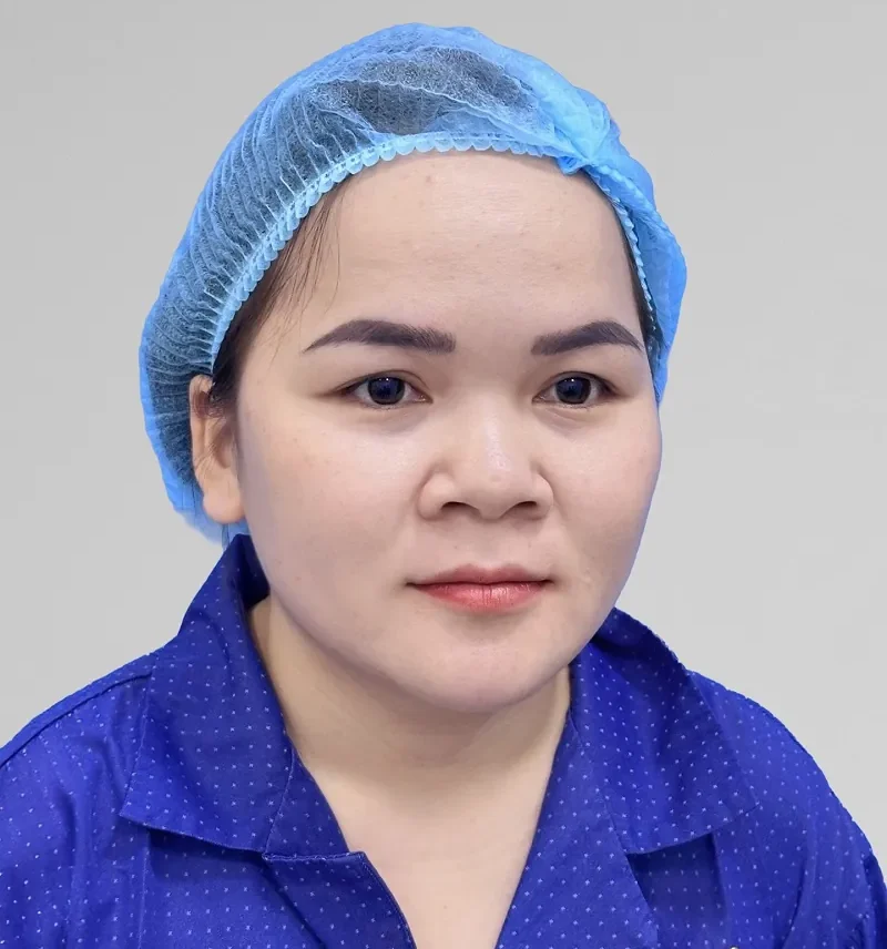 khách hàng Như Ý gặp tình trạng mũi thấp tẹt, cánh mũi to khiến gương mặt thô