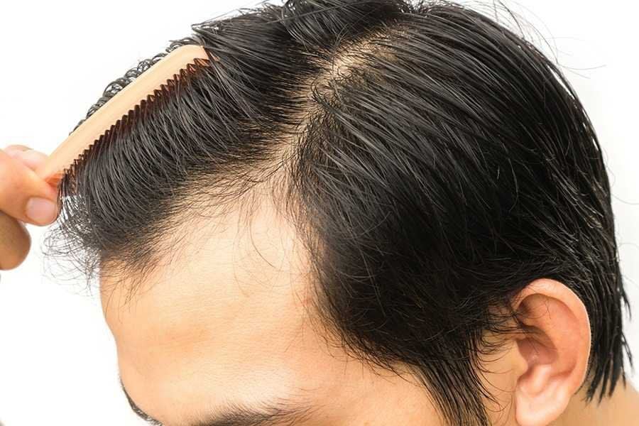 Nên chăm sóc đúng cách, theo chỉ định của bác sĩ