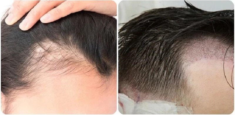 Khách hàng nên đi thăm khám để được đánh giá cụ thể