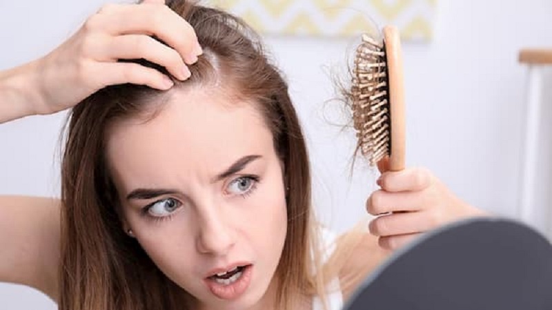 Cấy tóc có thể bị rụng sau thời gian đầu