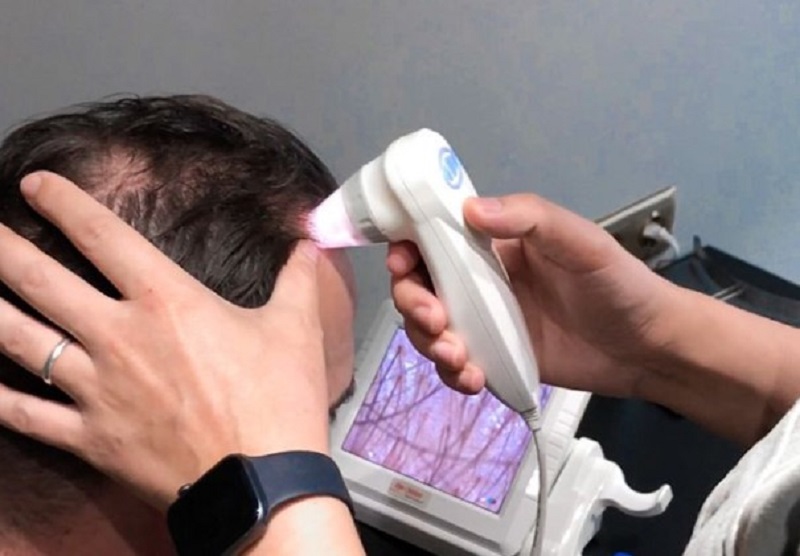 Bác sĩ sẽ thăm khám và kiểm tra tình trạng da đầu